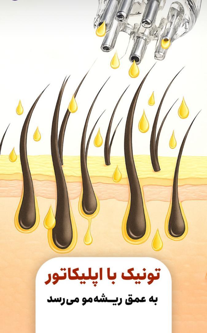 تونیک ضد ریزش و محرک رشد مجدد مو به همراه اپلیکاتور - EXONIC